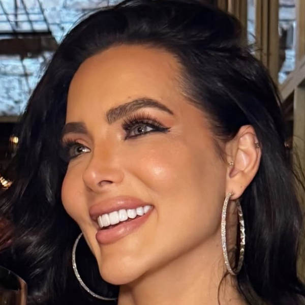 After: Eyebrow and hairline restoration - Patient 1