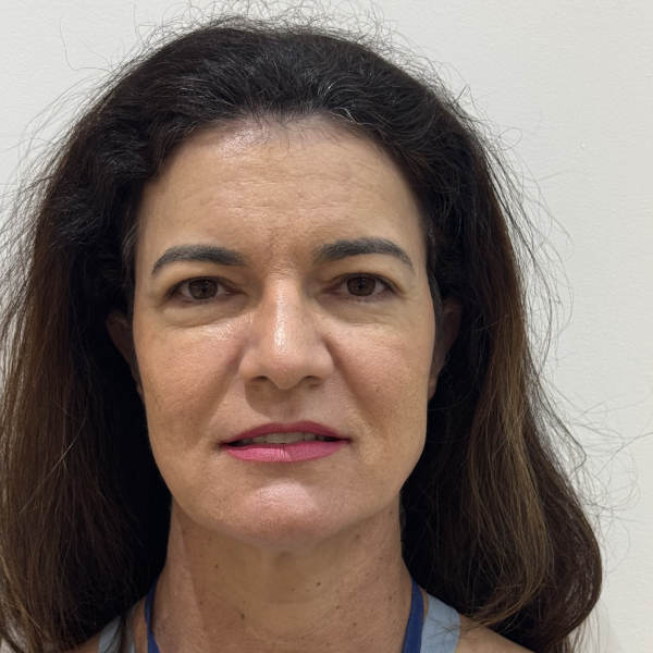 After: Women's hair restoration - Patient 2